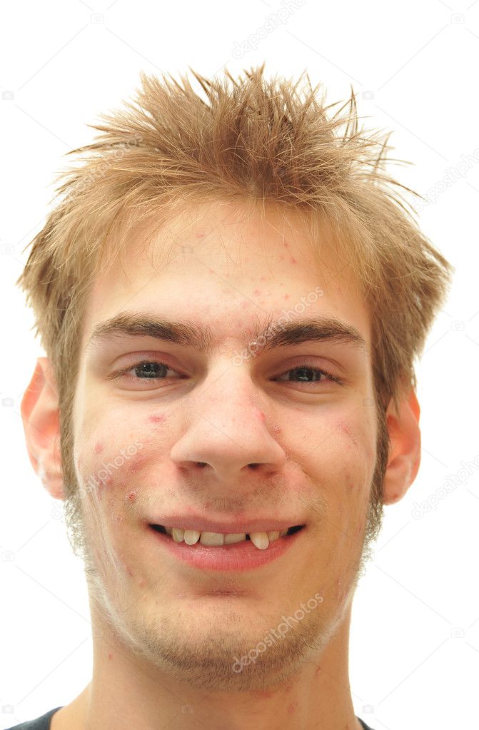 Man trying to smile with crooked teeth isolated on white