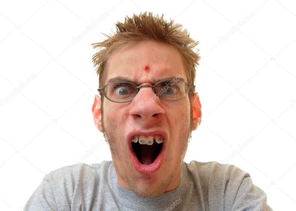 One single red pimple is seen on this young adults forehead isolated on white background.