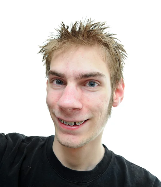 Teenager lächelt mit Zahnspange — Stockfoto