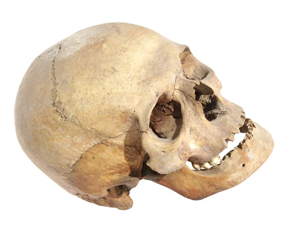 stock image Old skull of a man who lived in the past century