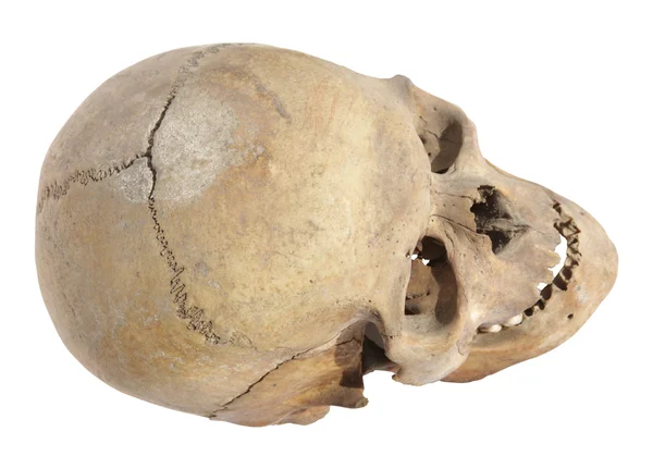 stock image Old skull of a man who lived in the past century