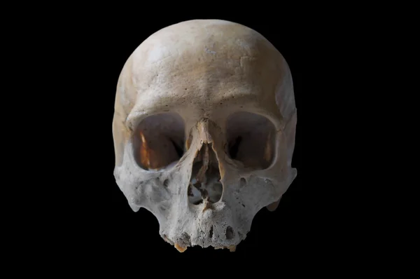 真正的人类头骨 — 图库照片