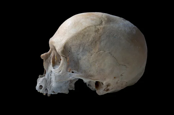 Cráneo humano real — Foto de Stock