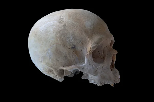 Verkliga mänskliga skalle — Stockfoto
