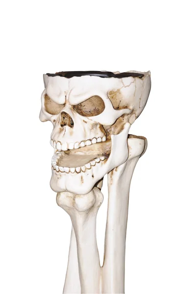 Crânio e ossos — Fotografia de Stock