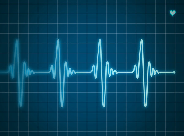 Blue electrocardiogram