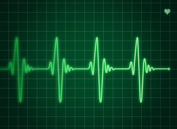 Zelený elektrokardiogramu — Stockový vektor